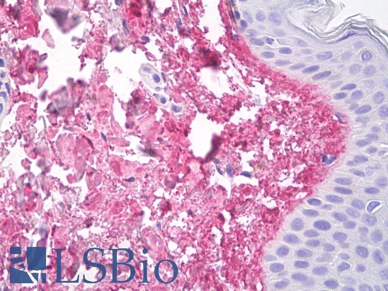 IHC-plus™ COL5A1 / Collagen V Alpha 1 Antibody (clone 18G5)