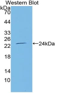TNFRSF11A / RANK Antibody (aa31-214)