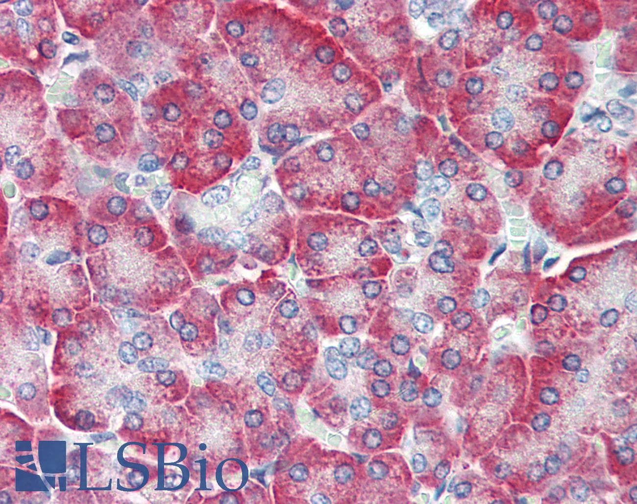 IHC-plus™ IRAK2 / IRAK-2 Antibody
