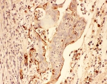 Polyclonal Rabbit anti-Human MMP7 / Matrilysin Antibody (aa1-267, IHC, WB)
