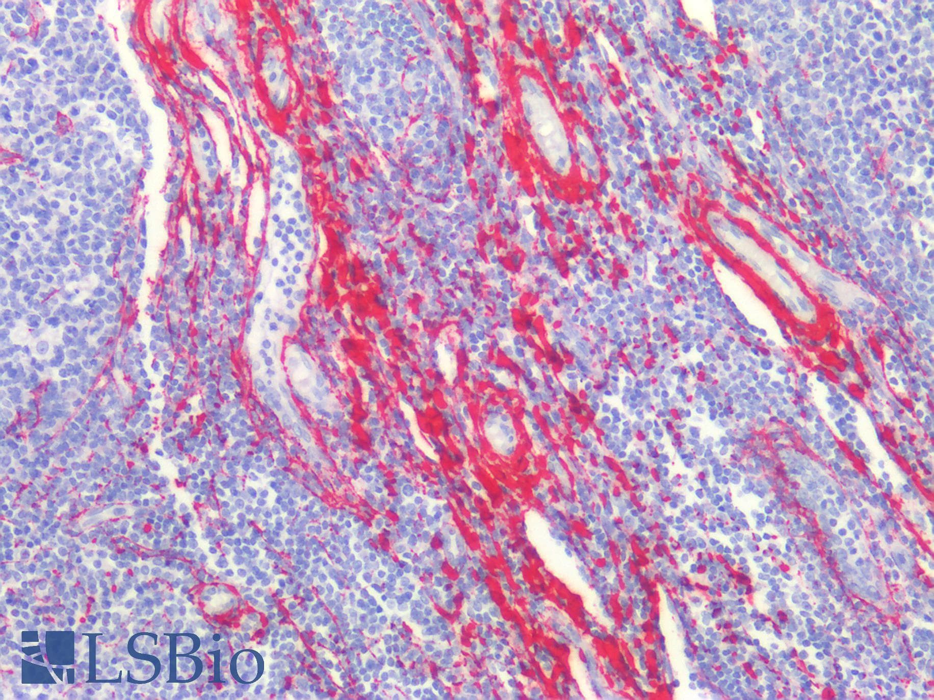 PathPlus™ Monoclonal Mouse anti-Human COL1A1 / Collagen I Alpha 1 Antibody (clone 3G3, IHC, WB)