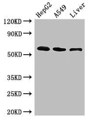 LIMPII / SCARB2 Antibody