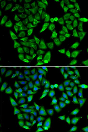 Polyclonal Rabbit anti-Human ASIP Antibody (IHC, IF)