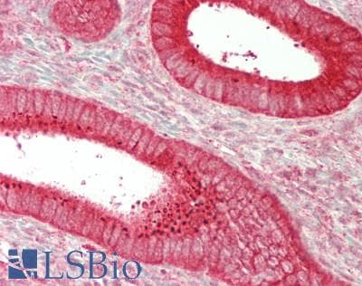 IHC-plus™ Monoclonal Mouse anti-Human PRDX1 / Peroxiredoxin 1 Antibody (IHC, IF, WB)