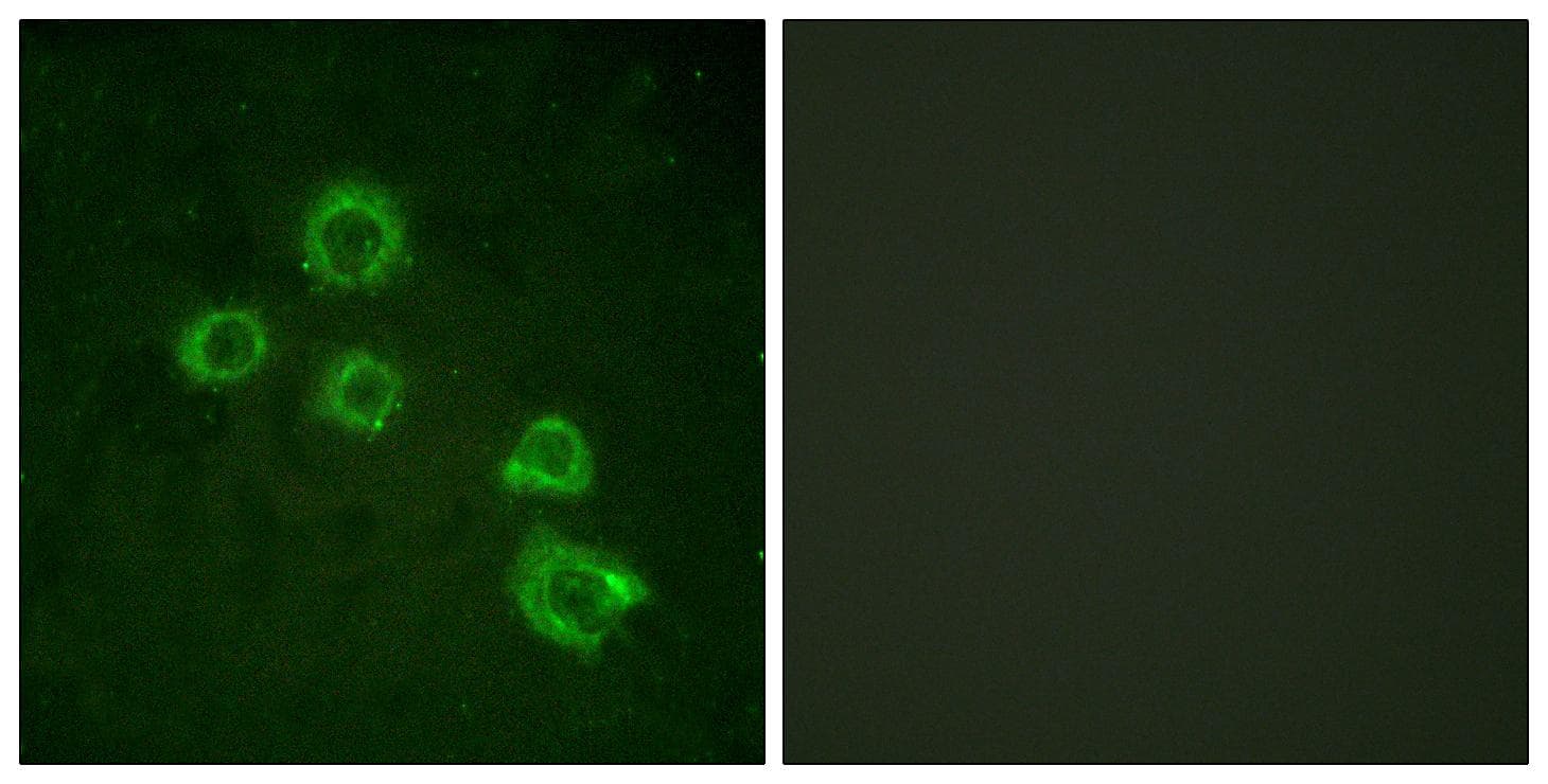 PLA2G4A Antibody (p505)