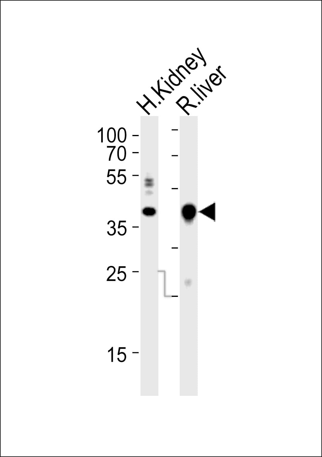 Polyclonal Rabbit anti-Mouse IHH Antibody (aa397-430, WB)
