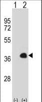 MEOX1 Antibody (aa136-165)