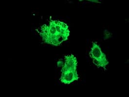FBXO31 Antibody (clone OTI1H1)