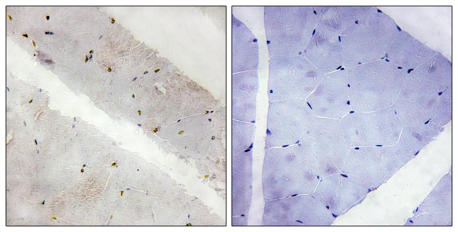 LATS2 Antibody