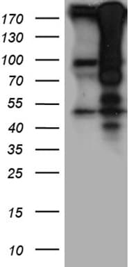 HIRA Antibody
