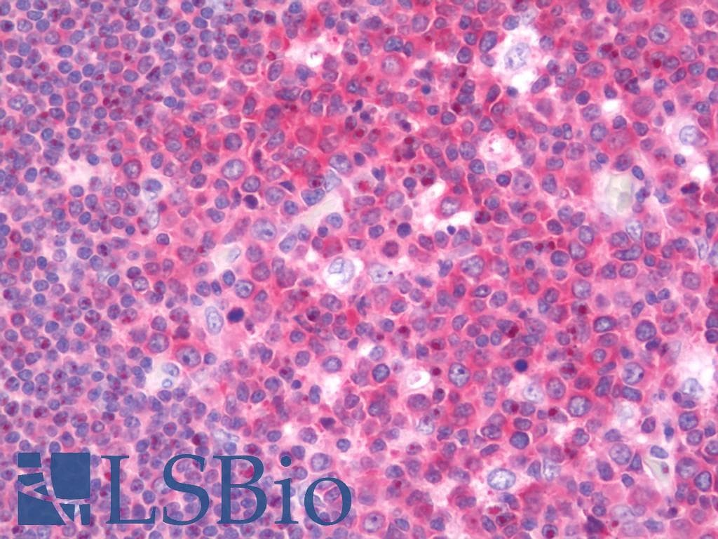 IHC-plus™ Polyclonal Rabbit anti-Human TNFRSF19L / RELT Antibody (aa361-410, IHC, WB)