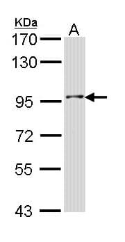 INPP5B Antibody (aa699-949)