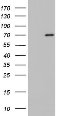 NUMB Antibody (aa1-365, clone OTI3B2)