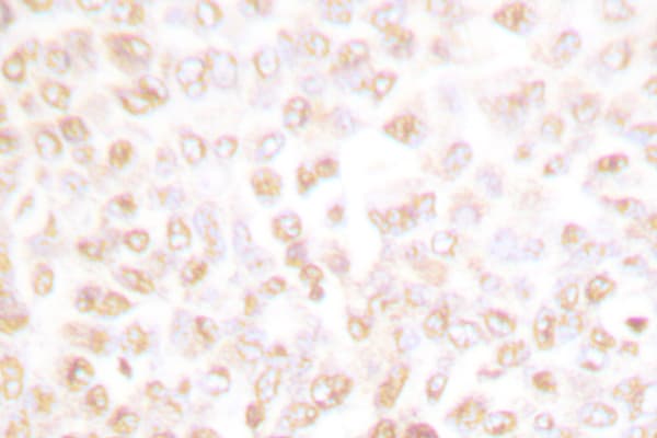 CDK2 Antibody (Val154)
