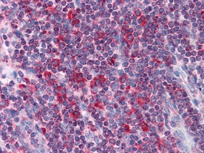 MTDH / Metadherin Antibody (clone 2F11C3)