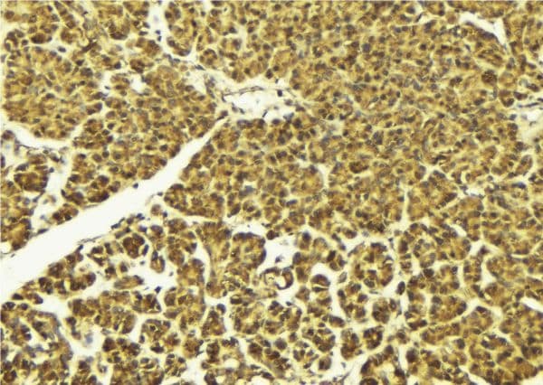 Polyclonal Rabbit anti-Human DUSP1 / MKP1 Antibody (IHC, IF, WB)