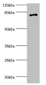 Polyclonal Rabbit anti-Human STAT4 Antibody (aa569-748, IHC, WB)