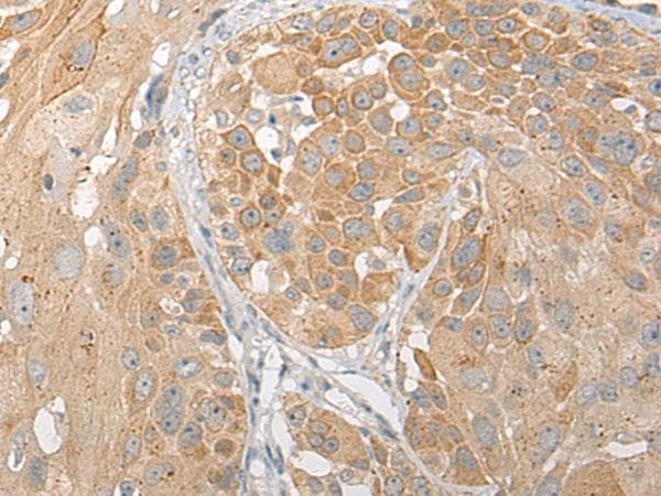 SNX6 Antibody