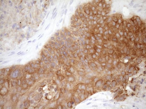 FSCN1 / Fascin Antibody (clone OTI5G1)