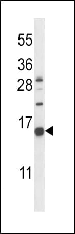 NPPC Antibody (aa80-109)