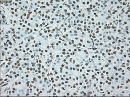 BRAF / B-Raf Antibody (clone OTI4C5)