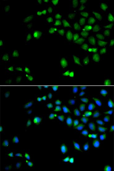 Polyclonal Rabbit anti-Human HOXA1 Antibody (IHC, IF, WB)