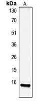 Gastrin Antibody (Internal)