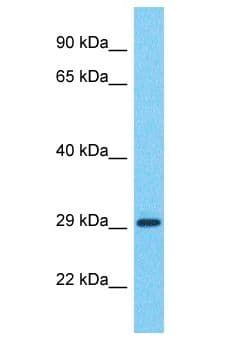 CT47A11 Antibody (aa238-287)