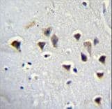 Polyclonal Rabbit anti-Human GRIN2A / NMDAR2A / NR2A Antibody (aa1057-1084, IHC, WB)