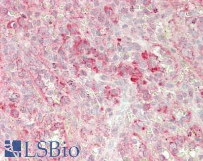 IHC-plus™ Polyclonal Rabbit anti-Human GUSB / Beta Glucuronidase Antibody (aa310-359, IHC, WB)