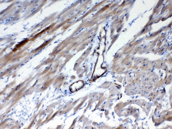 FZD4 / Frizzled 4 Antibody