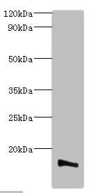Polyclonal Rabbit anti-Human TMEM14B Antibody (aa1-114, WB)