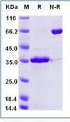 Human FGL1 / Hepassocin Protein (Recombinant His,C-terminus)