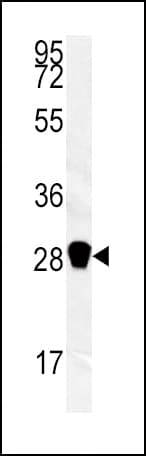 IHC-plus™ Polyclonal Rabbit anti-Human CA3 / Carbonic Anhydrase III Antibody (aa17-46, IHC, WB)