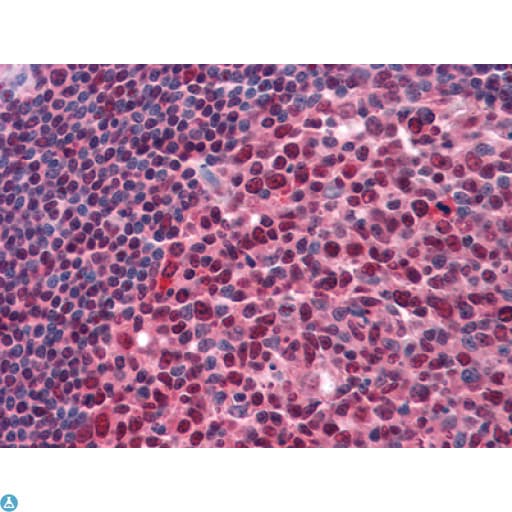 Monoclonal Mouse anti-Human RCHY1 / PIRH2 Antibody (IHC, IF, WB)