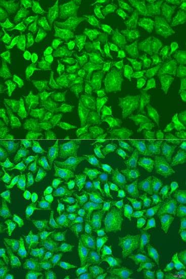 DVL2 / Dishevelled 2 Antibody