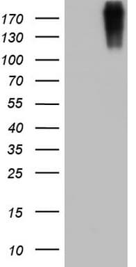 VWF / Von Willebrand Factor Antibody (aa764-1263, clone OTI6C7)