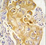 PGIS / PTGIS Antibody (aa30-61)