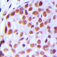 TAF5L Antibody (Internal)