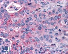 PathPlus™ P2RY14 / GPR105 Antibody (Extracellular Domain)