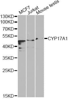 Polyclonal Rabbit anti-Human CYP17 / CYP17A1 Antibody (IHC, WB)