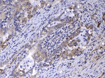 RLN1 / Relaxin Antibody