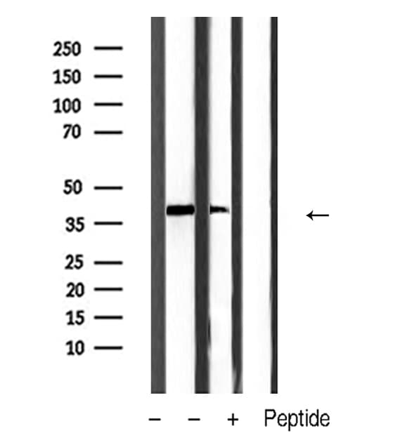 Polyclonal Rabbit anti-Human ANXA2 / Annexin A2 Antibody (IHC, WB)