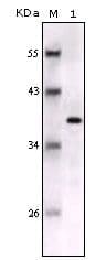 S100B / S100 Beta Antibody (clone 9A11B9)