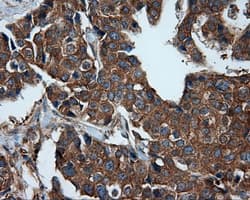 PIM2 / Pim-2 Antibody (clone OTI8G10)