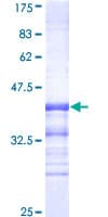 Human CDK8 Protein (Recombinant GST, N-terminus)