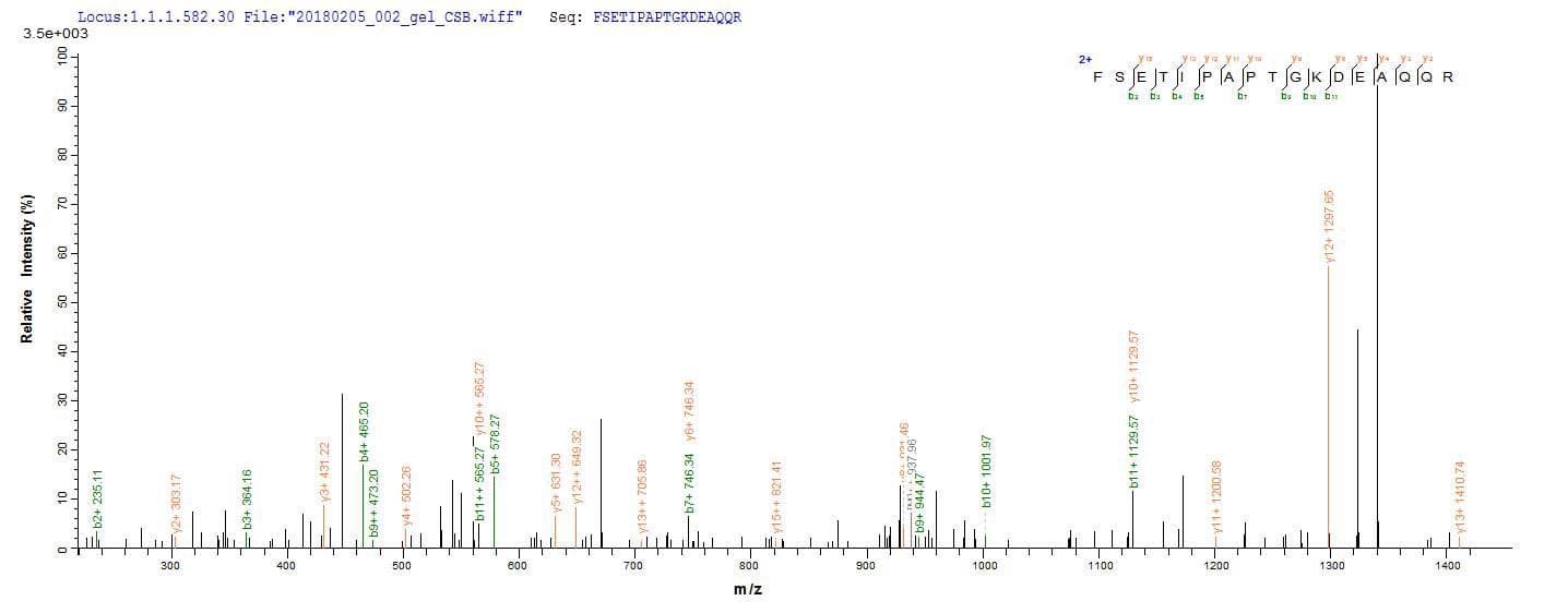 Pig GH / Growth Hormone Protein (Recombinant 10His, N-terminus + Myc, C-terminus)
