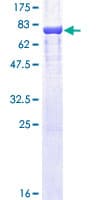 Human ODC1 / Ornithine Decarboxylase Protein (Recombinant GST)