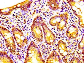 CAPRIN1 Antibody