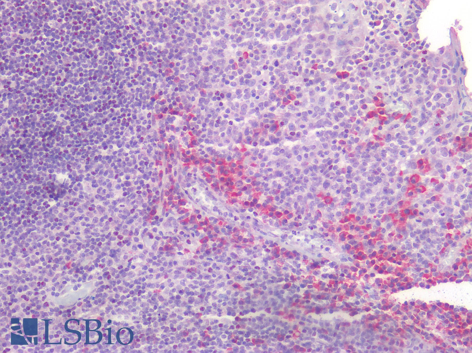 PathPlus™ USP19 Antibody